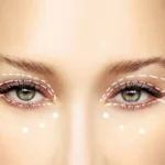 Blepharoplasty in Dubai