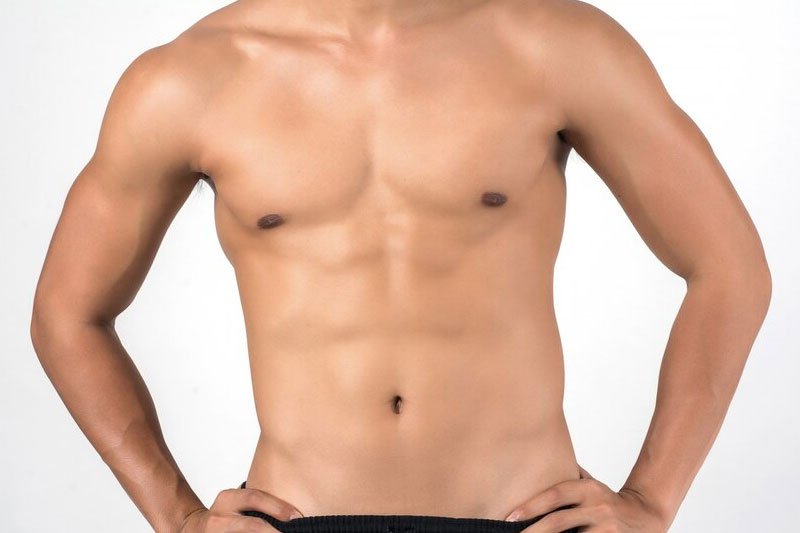 Gynecomastia